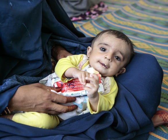 A child eats Plumpy'Nut, a peanut paste used to treat malnutrition.
