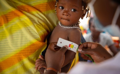 Young child is accessed for malnutrition with a MUAC band.