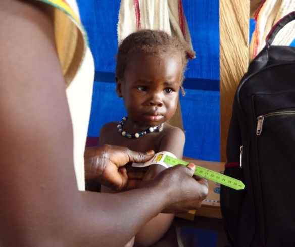 A child is screened for malnutrition in Chad.