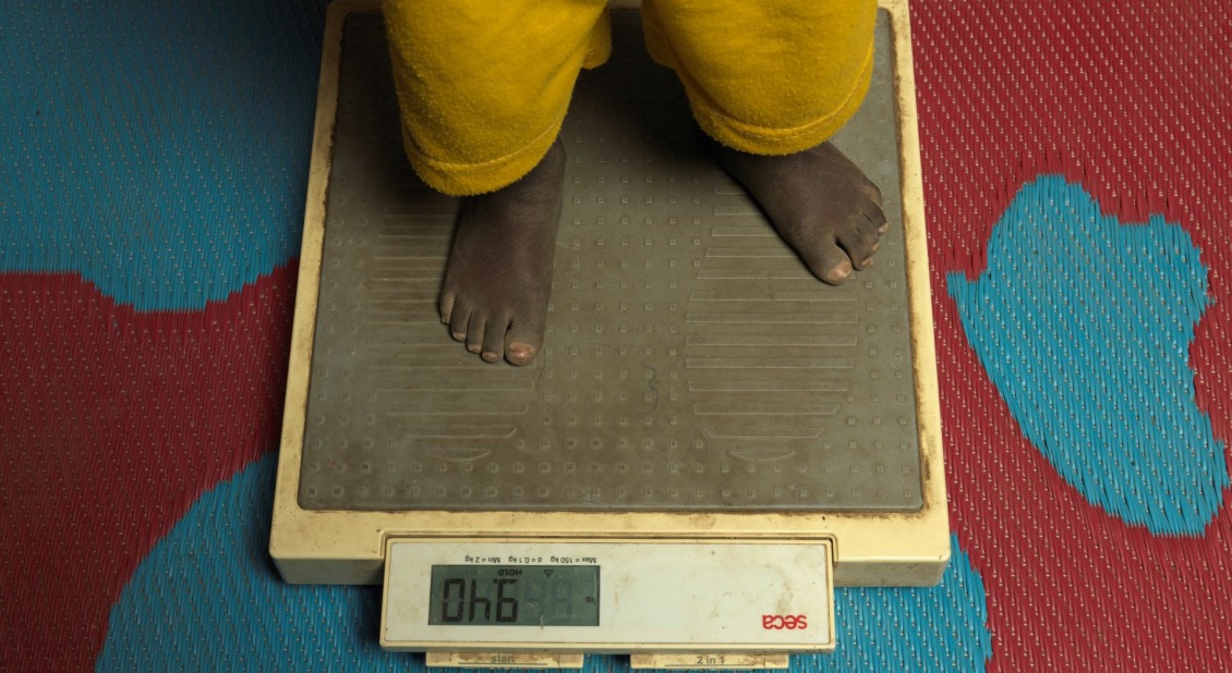 A child on a scale in South Sudan.
