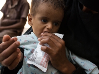 A child receives treatment for malnutrition from his mother