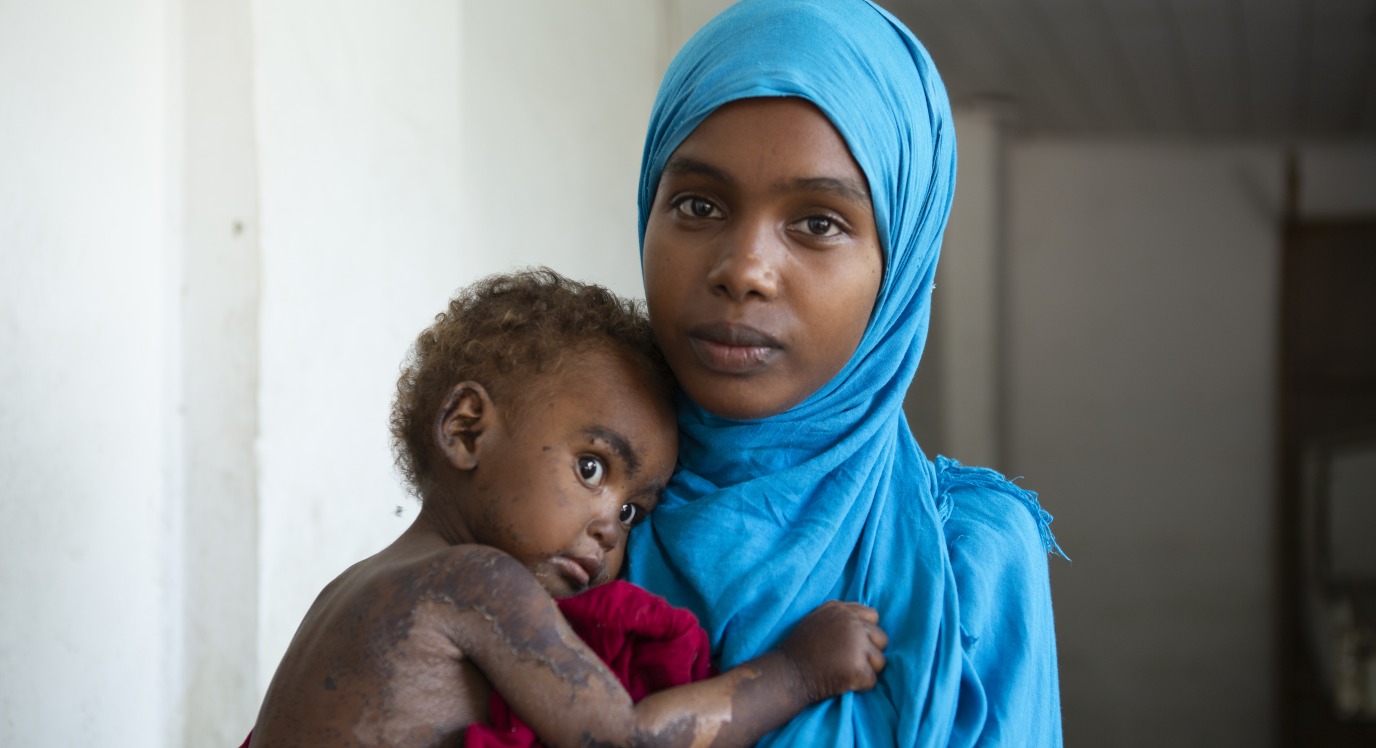 A woman holder her baby in Somalia