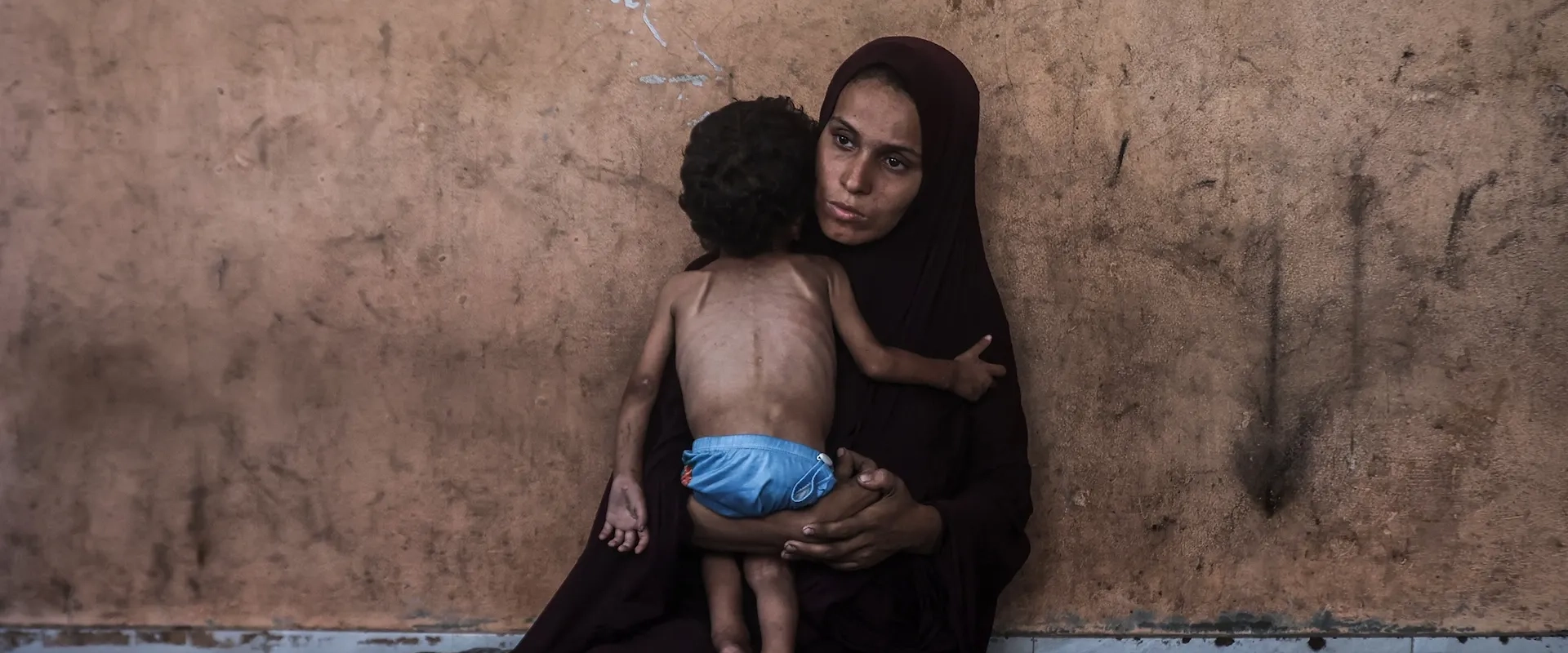A woman holds a severely malnourished child in Gaza.